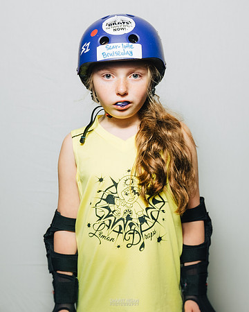 Scar-lotte Bruiseday